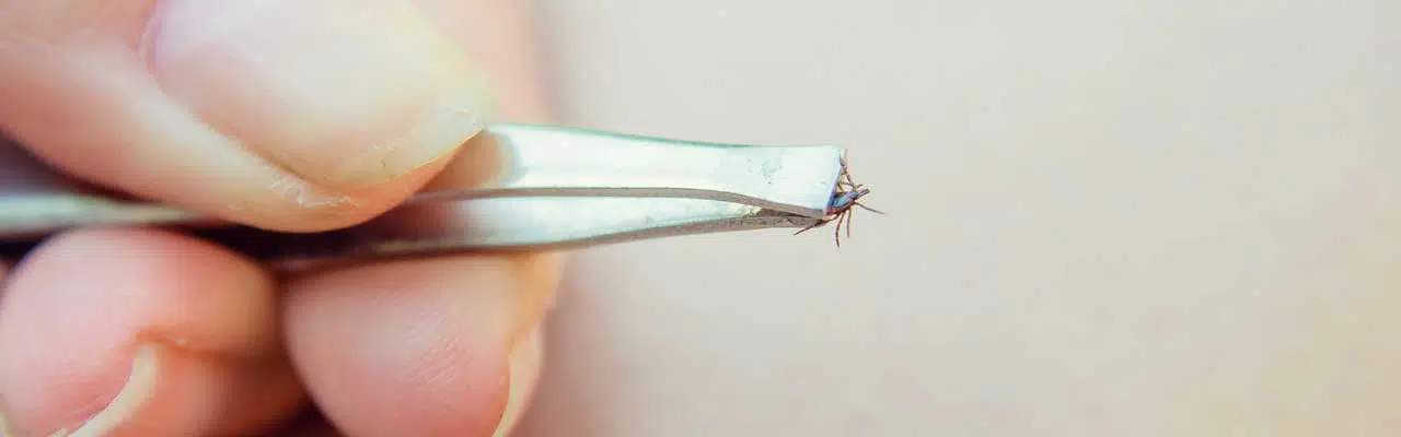How to safely remove ticks from the human body